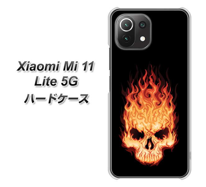 Mi 11 Lite 5G 364 ドクロの怒り ハードケース 背面印刷