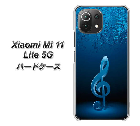 Mi 11 Lite 5G 588 オーケストラ ハードケース 背面印刷