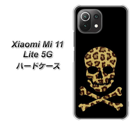 Mi 11 Lite 5G 1078 ドクロフレームヒョウその他のカラー ハードケース 背面印刷
