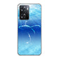 OPPO A77 1047 海の守り神くじら ハードケース 背面印刷
