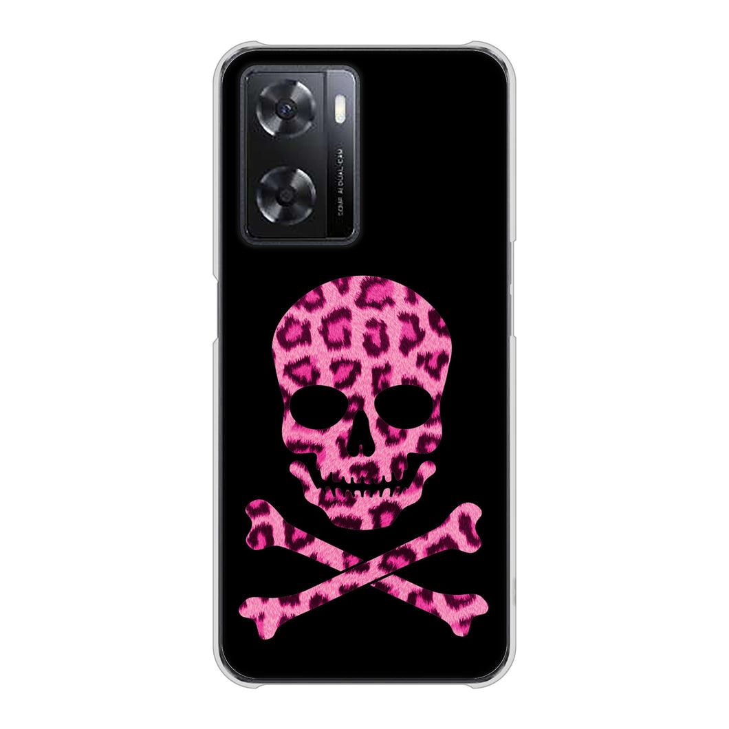 OPPO A77 1079 ドクロフレームヒョウピンク ハードケース 背面印刷