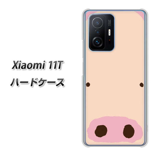 Xiaomi 11T 353 ぶた ハードケース 背面印刷