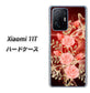 Xiaomi 11T VA824 魅惑の蝶とピンクのバラ ハードケース 背面印刷