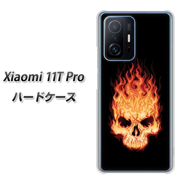 Xiaomi 11T Pro 364 ドクロの怒り ハードケース 背面印刷